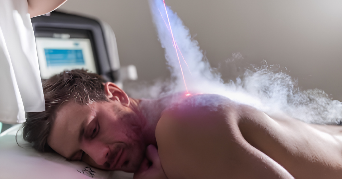 cryo 2